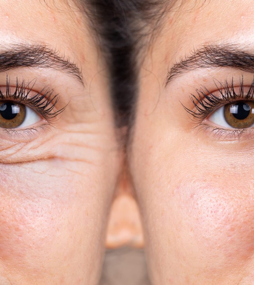 A young woman shows the before and after results of successful b A young woman shows the before and after results of successful b